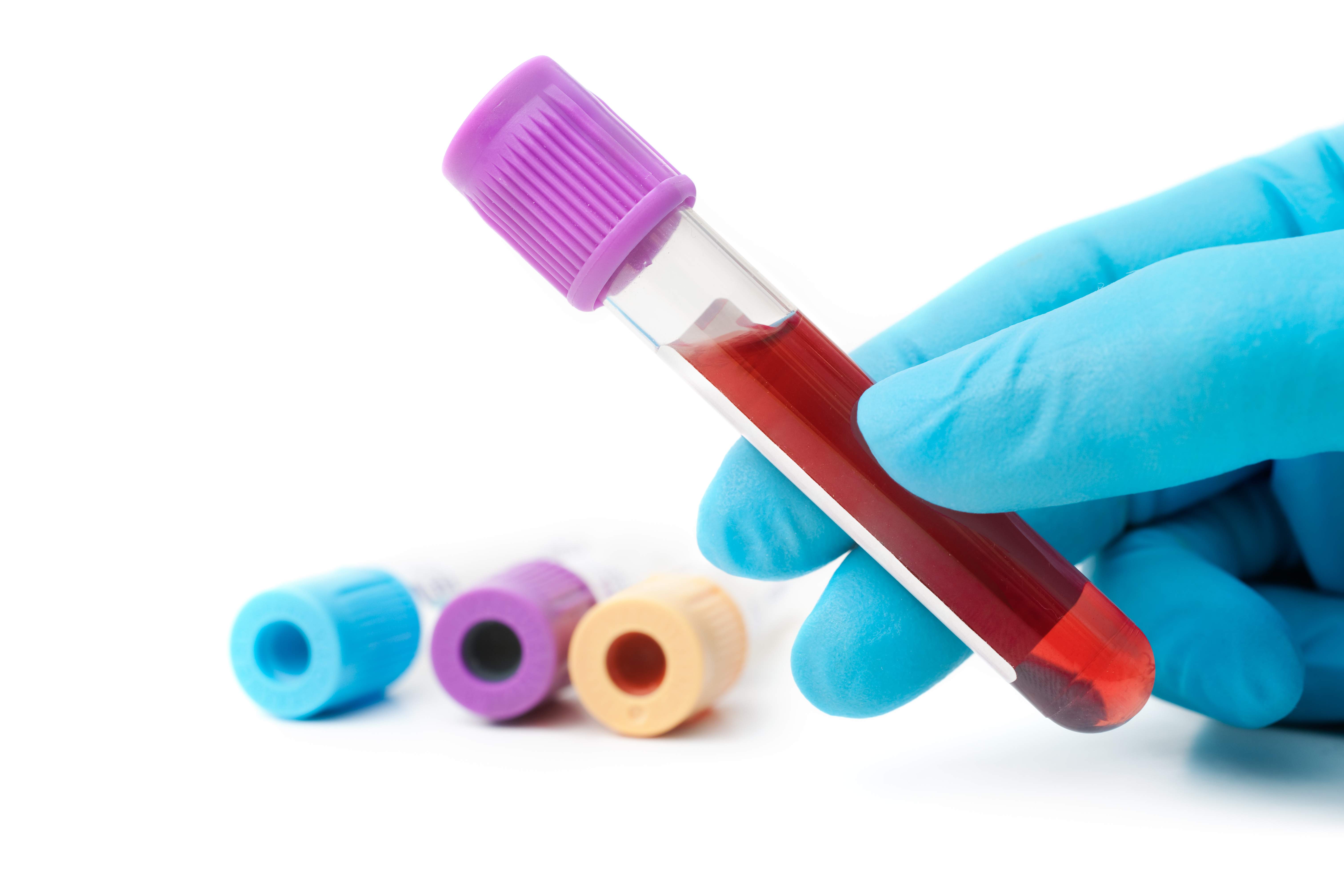 MENOPAUSE BLOOD TESTS